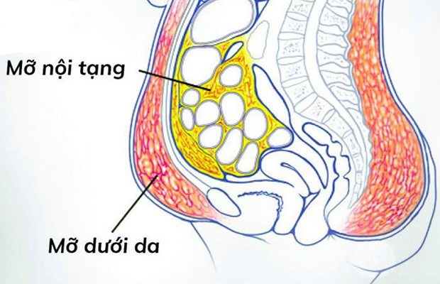 Mỡ bụng dưới khó giảm - mỡ dưới da và mỡ nội tạng